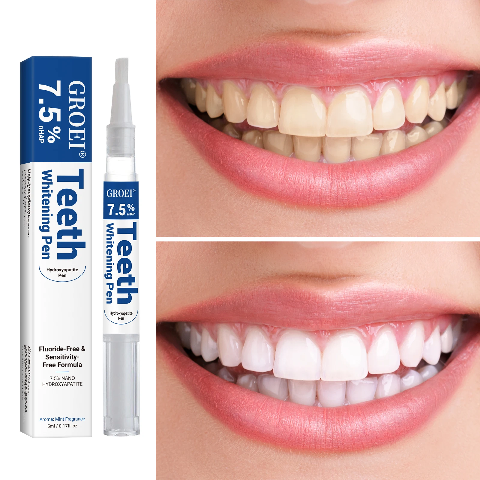 Hydroxyapatite Tooth Whitening - Teeth Whitening Results 评论和价格