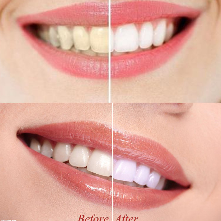 Bamboo Charcoal Teeth Tooth De - Teeth Whitening Filter 评论和价格