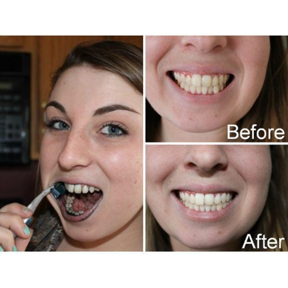 Bamboo Charcoal Teeth Tooth De - Teeth Whitening Filter 评论和价格