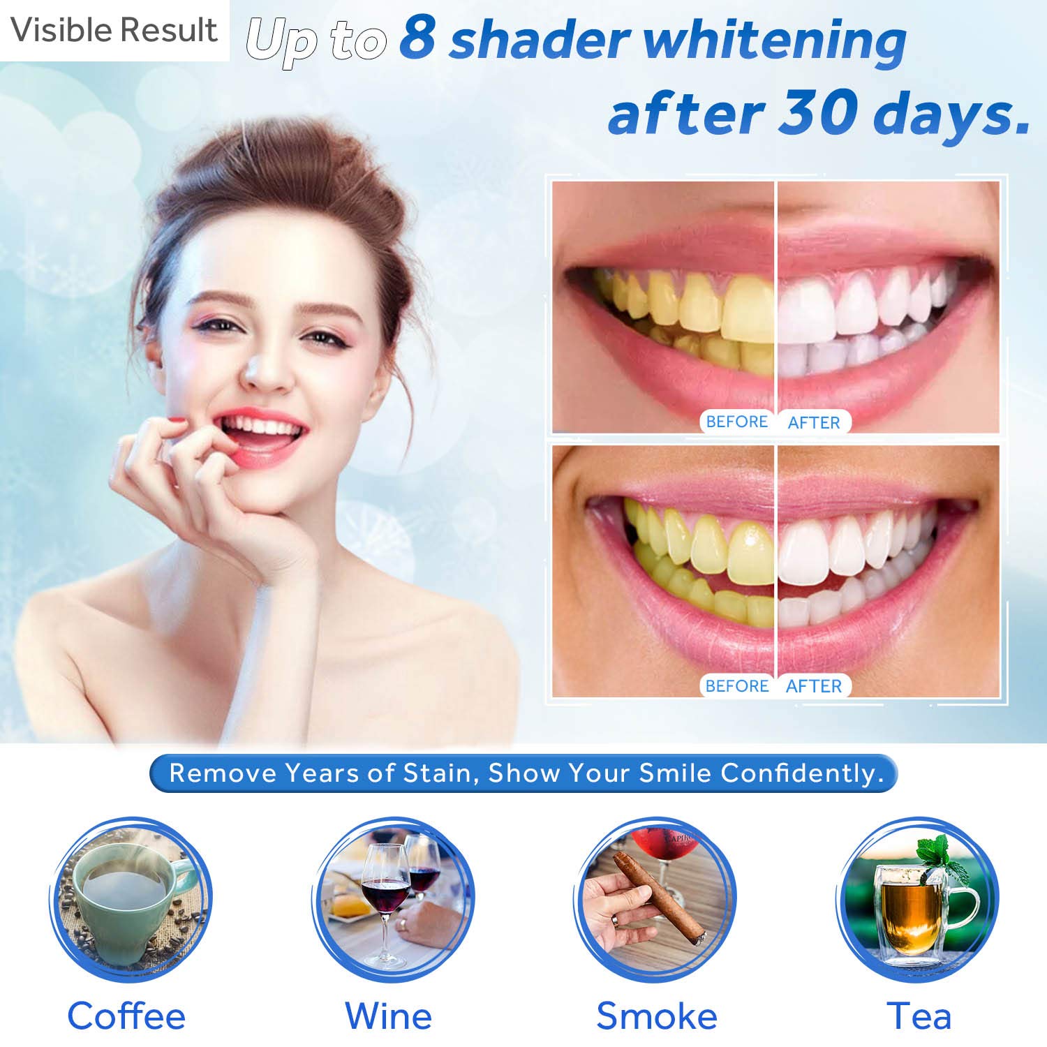 Teeth Whitening Gel Refill Syr - Teeth Whitening Results 评论和价格