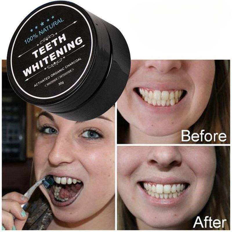 1 Box Activated Charcoal Teeth - Teeth Whitening Filter 评论和价格