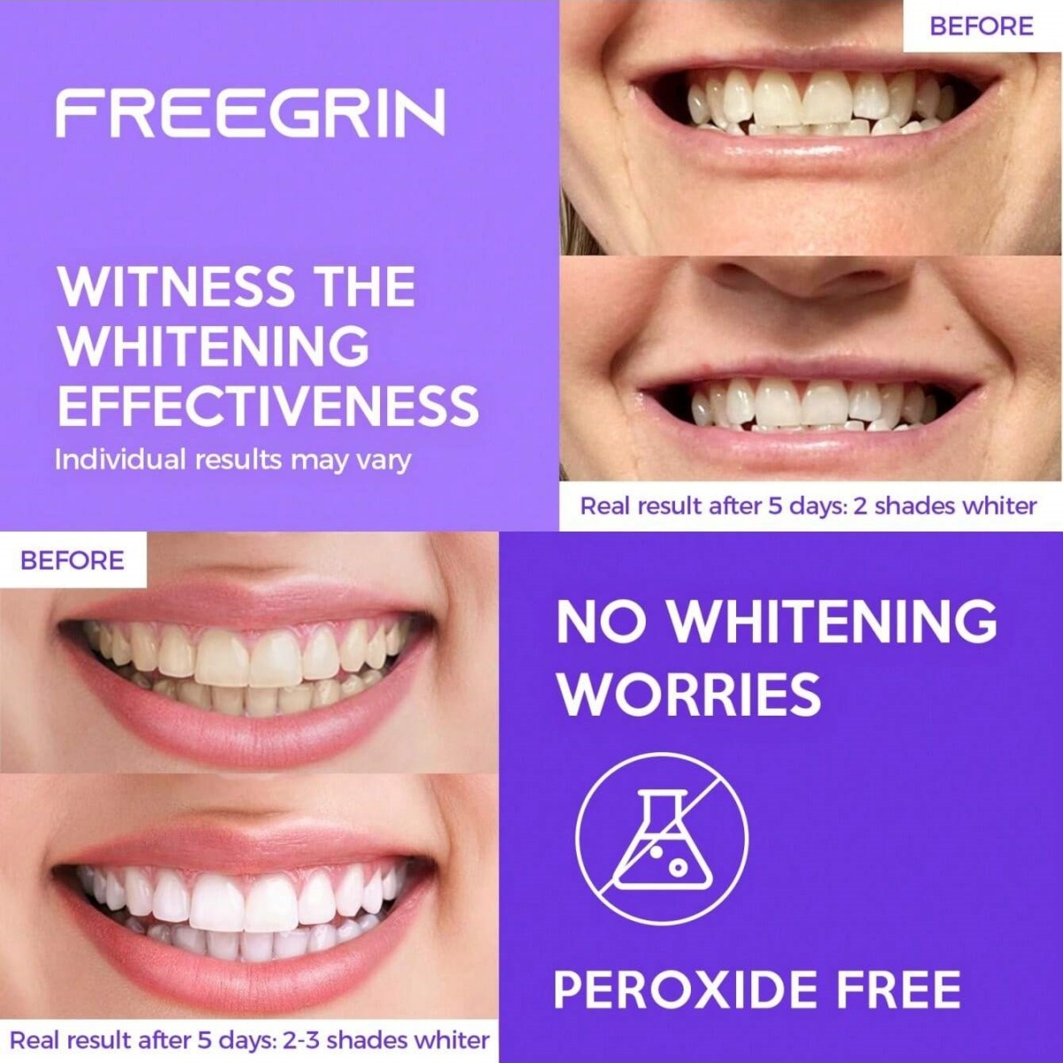 Deluxe Whitening Teeth Sticker - Teeth Whitening Results 评论和价格
